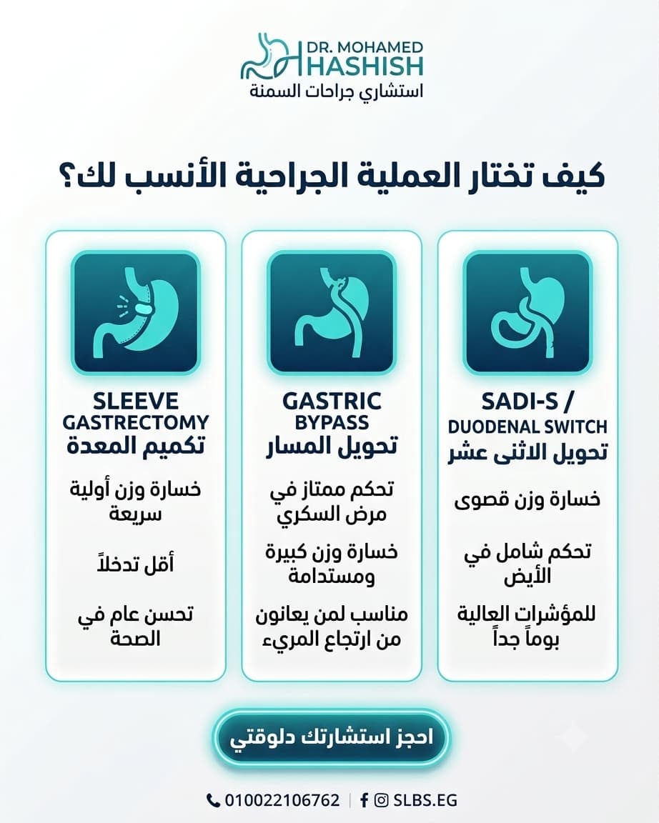 إزاي تختار العملية المناسبة ليك؟